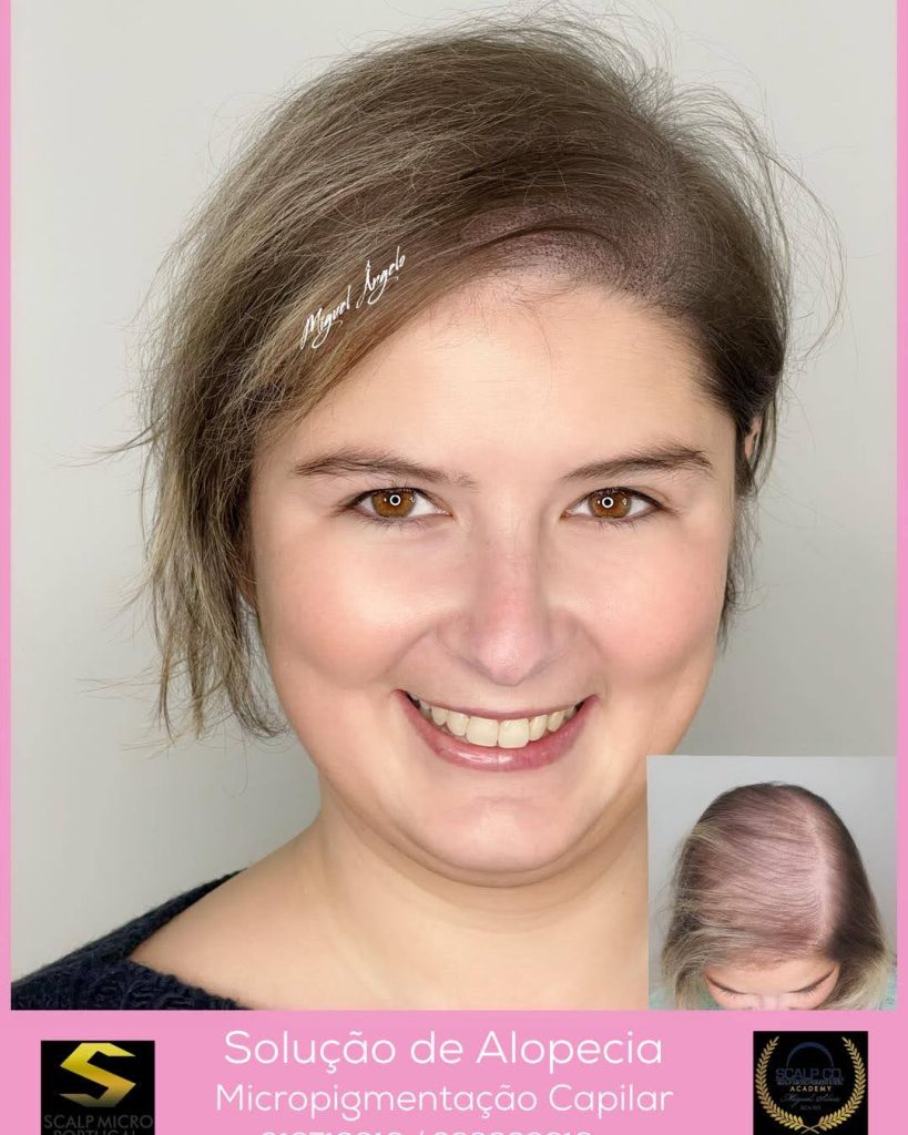 Woman hair Density